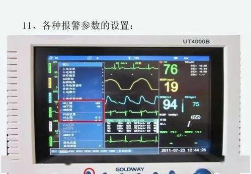 心电监护操作流程视频,心电监护操作流程视频要点解析